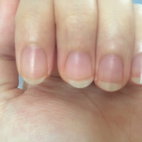 爪が小さくて美しくない タイトル通り 爪が美しくなくて悩 Q A Cosme アットコスメ 爪が小さくて美しくない タイトル通り 爪が美しくなくて悩 Q A Cosme アットコスメ