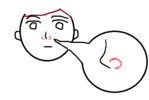 小鼻の線がくっきりして、赤黒い？です