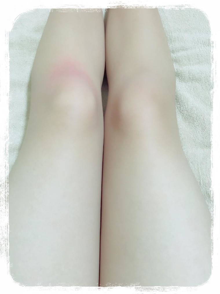 膝チーク シャラン さんのブログ Cosme アットコスメ