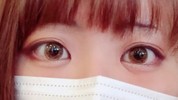 蒙古襞(目頭下の線)について