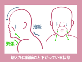 口輪筋を鍛えすぎました ほうれい線と 口角が下がってい Q A Cosme アットコスメ