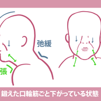 口輪筋を鍛えすぎました ほうれい線と 口角が下がってい Q A Cosme アットコスメ 口輪筋を鍛えすぎました ほうれい線と 口角が下がってい Q A Cosme アットコスメ