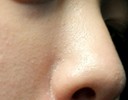 眉間のブツブツ、小鼻の角栓はどうしたら改善できますか？