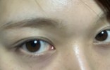 目が大きい人に向いてるアイクリーム、アイケア