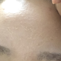 Botanical Peel ボタニカルピーリングパウダー ベースジェルの公式商品情報 美容 化粧品情報はアットコスメ Botanical Peel ボタニカルピーリングパウダー ベースジェルの公式商品情報 美容 化粧品情報はアットコスメ