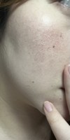 化粧崩れについて