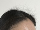 アホ毛を押さえるには