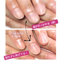 自爪が伸びると割れる とお困りのお客さまの 自爪表面を一切削らない お悩みカバーネイル 無料で育爪効果も付いてくる Irokuzu Saeさんのブログ Cosme アットコスメ
