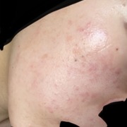 薬用ホワイトパックN / 透明白肌(トウメイシロハダ)へのクチコミ投稿画像