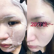 真水素フェイスマスク / Kyo Tomoへのクチコミ投稿画像