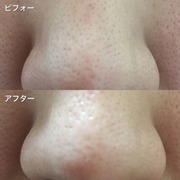 ソワンポアリペアローション / ソワンへのクチコミ投稿画像