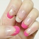 sNlC