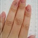 Mynail