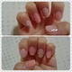 Mynail